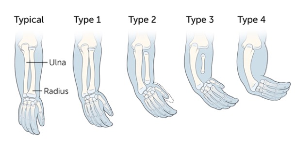 radiclub-hand-1
