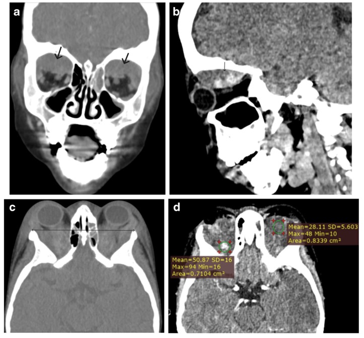 Capture d’écran 2025-11-16 à 11.17.23