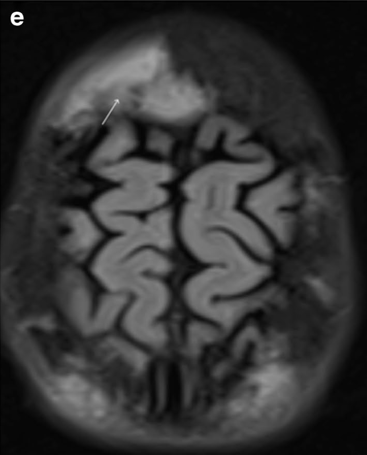 Capture d’écran 2025-11-16 à 11.17.59