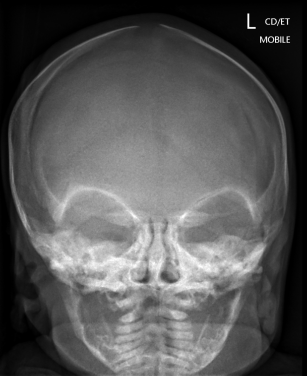 299b956a34aa297cd52375cb4149e6ed8c1bef83f7bdb8e7bab95dbd84d146d3