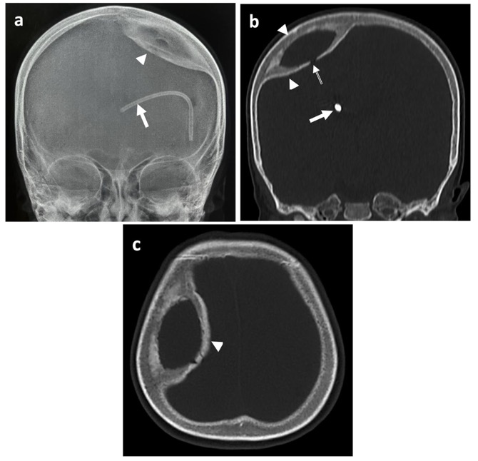 Capture d’écran 2025-11-16 à 11.21.02
