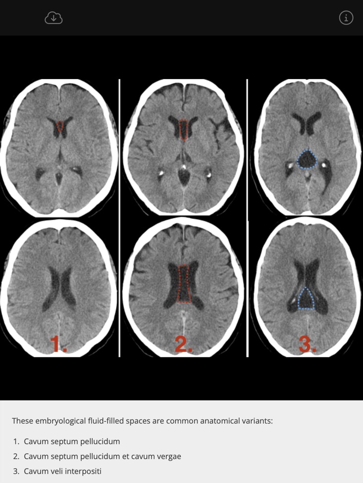 Capture d’écran 2025-12-06 à 05.59.40