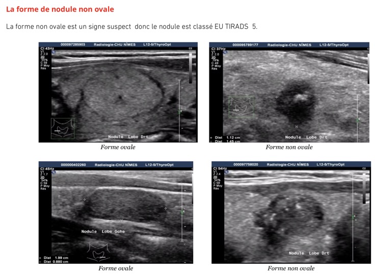 Capture d’écran 2025-11-08 à 10.23.53