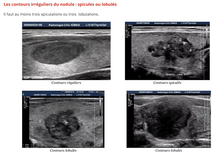 Capture d’écran 2025-11-08 à 10.24.04