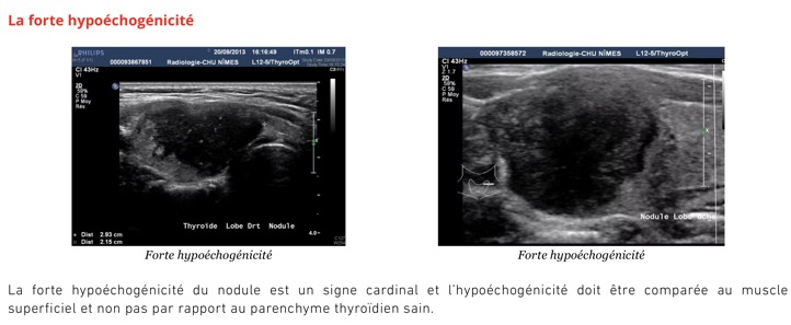 Capture d’écran 2025-11-08 à 10.24.18