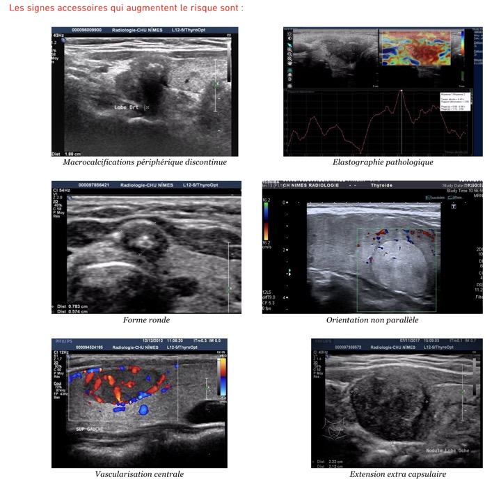 Capture d’écran 2025-11-08 à 10.25.49