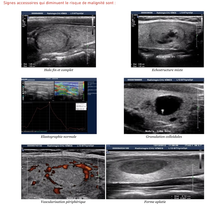 Capture d’écran 2025-11-08 à 10.25.56