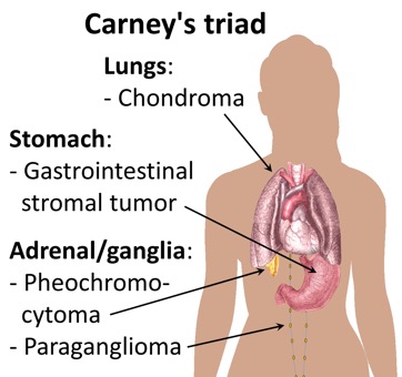Carney&#39;s_triad