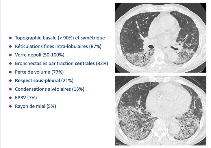 Capture d’écran 2026-02-22 à 09.09.07