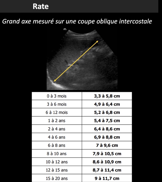 Capture d’écran 2025-05-26 à 08.39.25