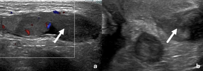 Capture d’écran 2025-10-22 à 12.18.09