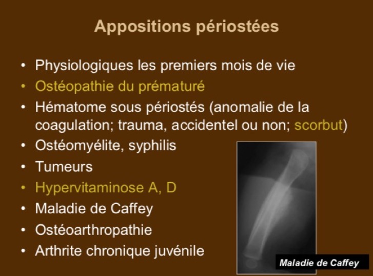 Appositions périostées