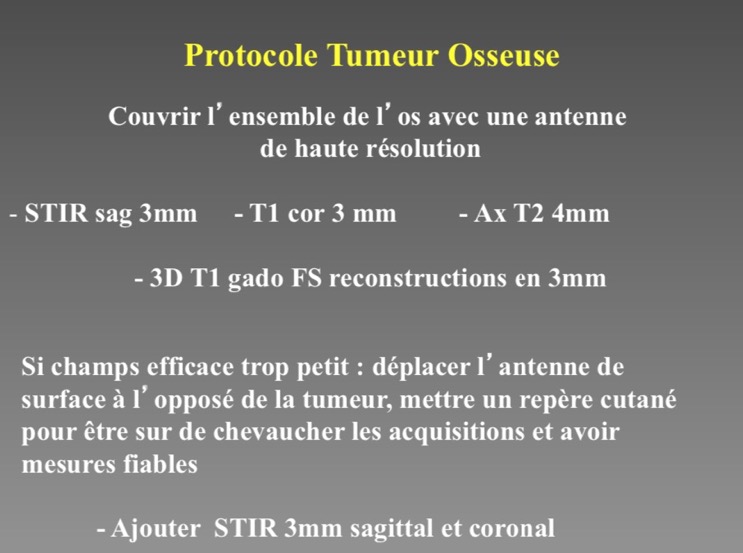 Protocole Tumeur Osseuse