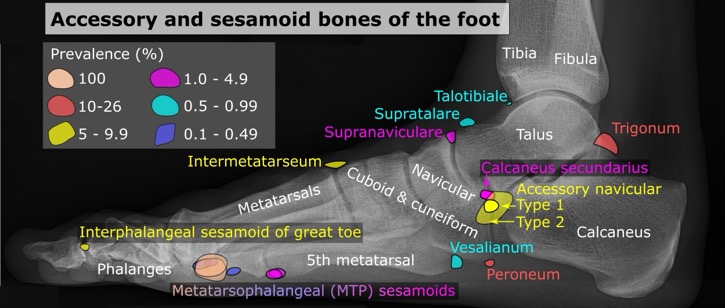 Accessory_and_sesamoid_bones_of_the_foot_-_lateral_projection