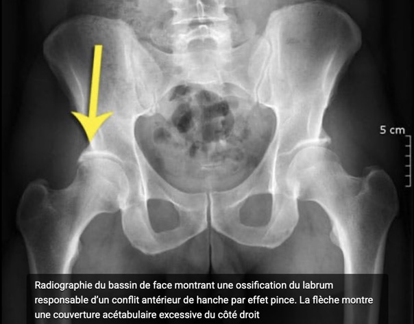 Capture d’écran 2025-11-16 à 10.37.01