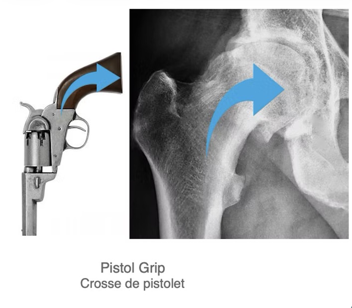 Capture d’écran 2025-11-16 à 10.41.21