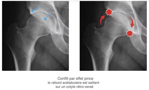 Capture d’écran 2025-11-16 à 10.51.44