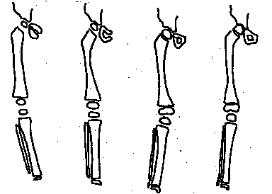 15_ORTHOP_DIE_COURANTE2