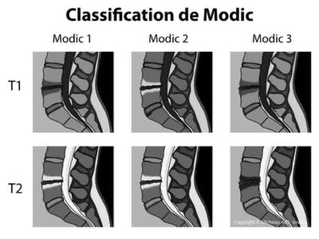 MODIC