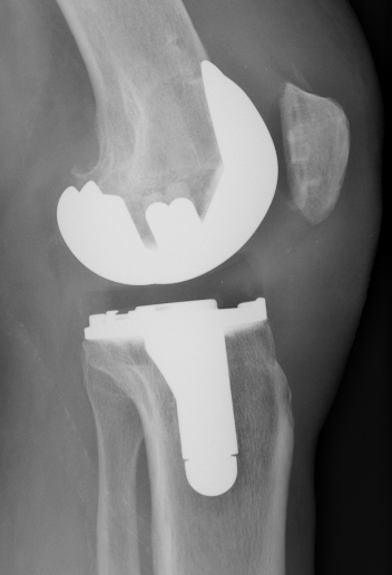 radio-ptg-docteur-simian-perigueux