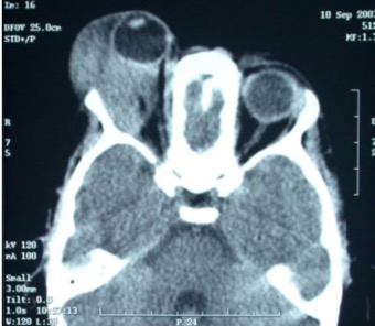 Figure_3-41