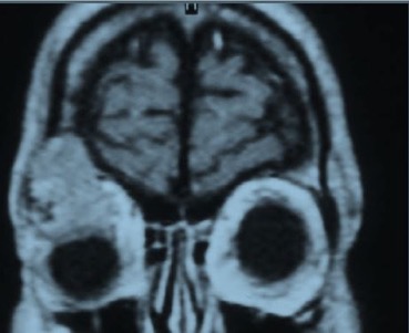 Figure_4-23