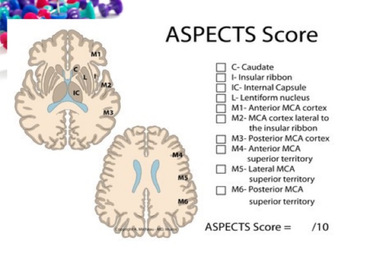 score ASPECT