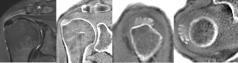 image 2_0