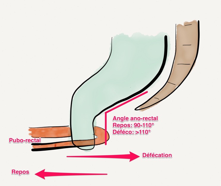 angle puborectal